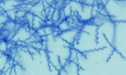 Borrelia
